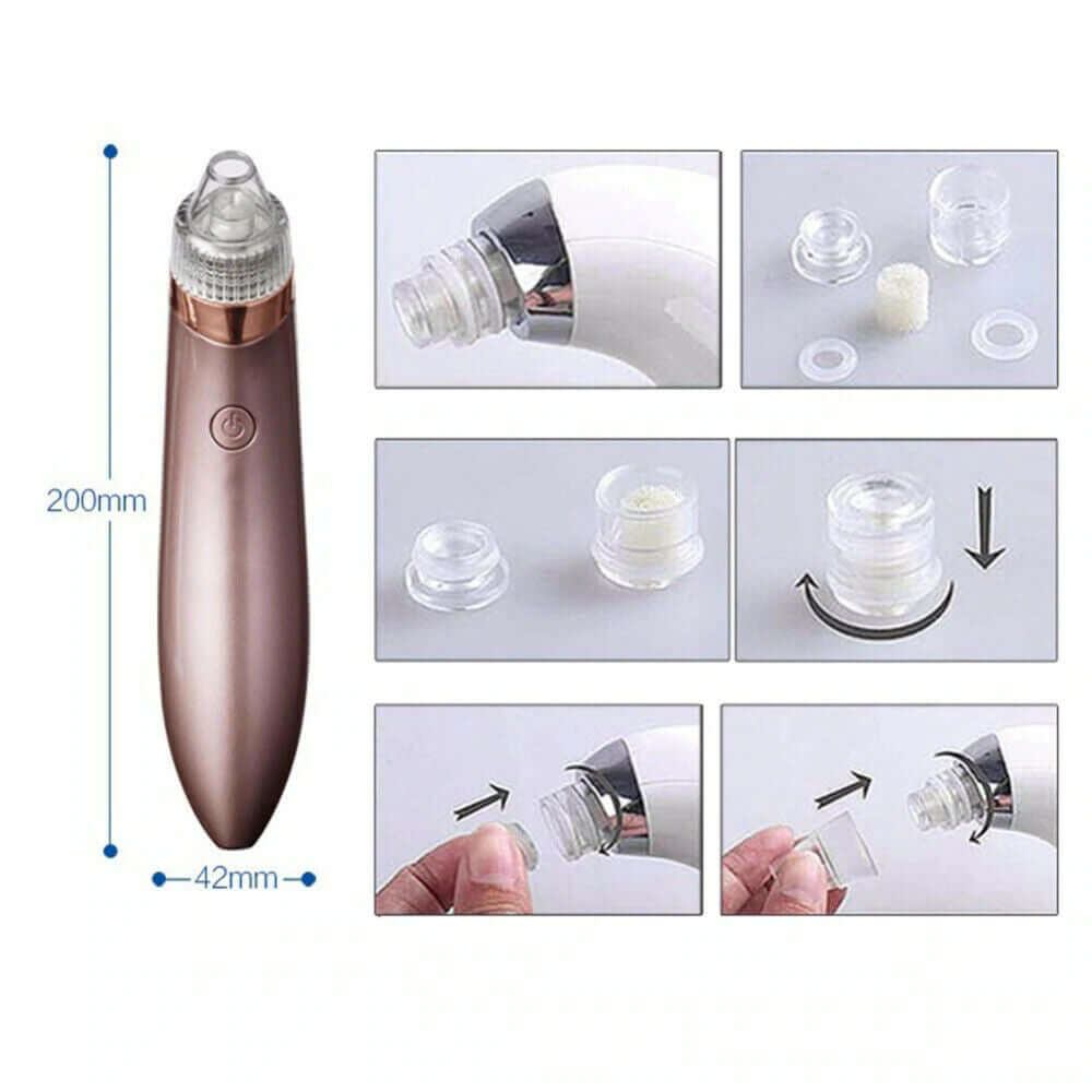 Electric Blackhead Vacuum: Pore Cleaner, Acne Remover & Diamond Dermabrasion Tool