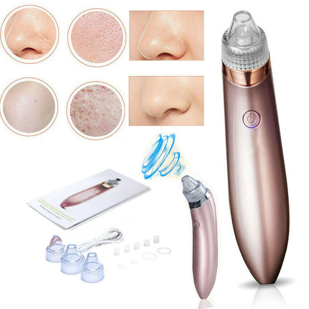 Electric Blackhead Vacuum: Pore Cleaner, Acne Remover & Diamond Dermabrasion Tool