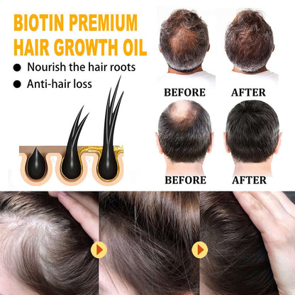 EELHOE Biotin Hair Treatment Oil