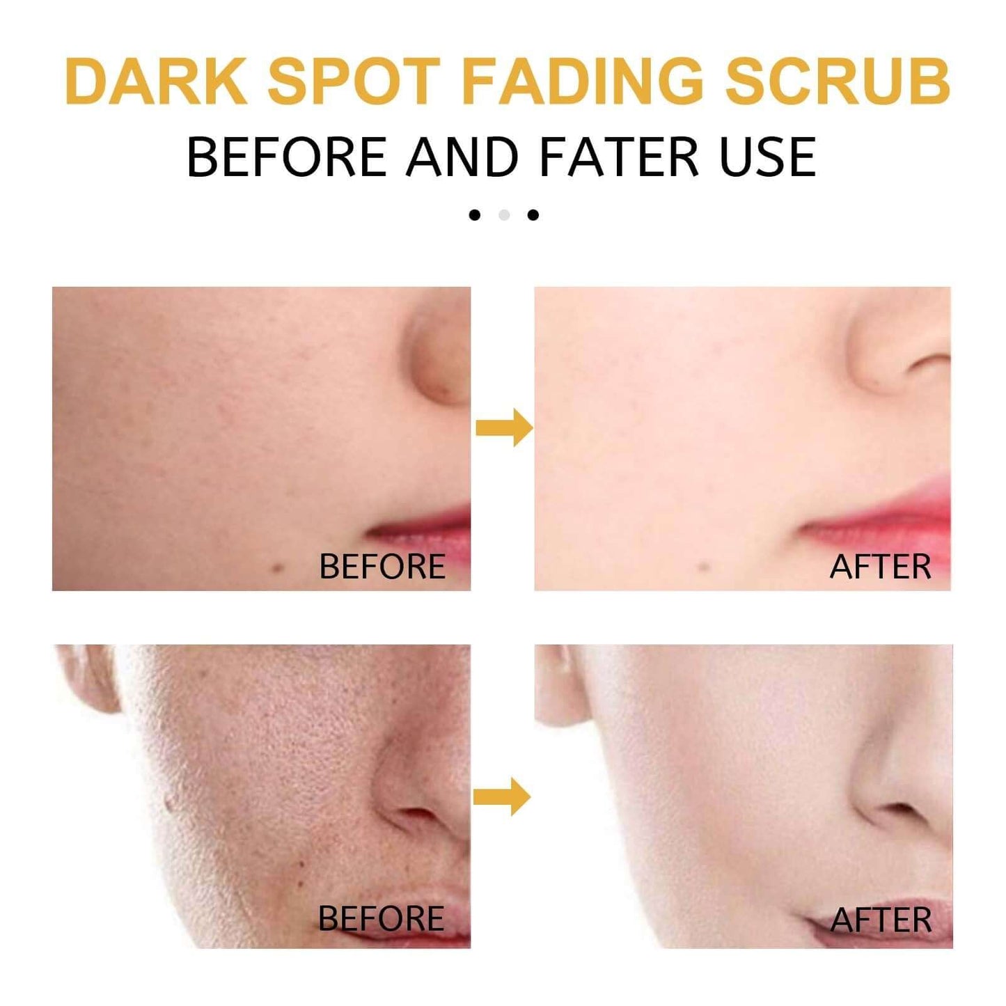 Dark Spot Fading Scrub – Turmeric, Avocado & Jojoba Deep Cleansing Exfoliator