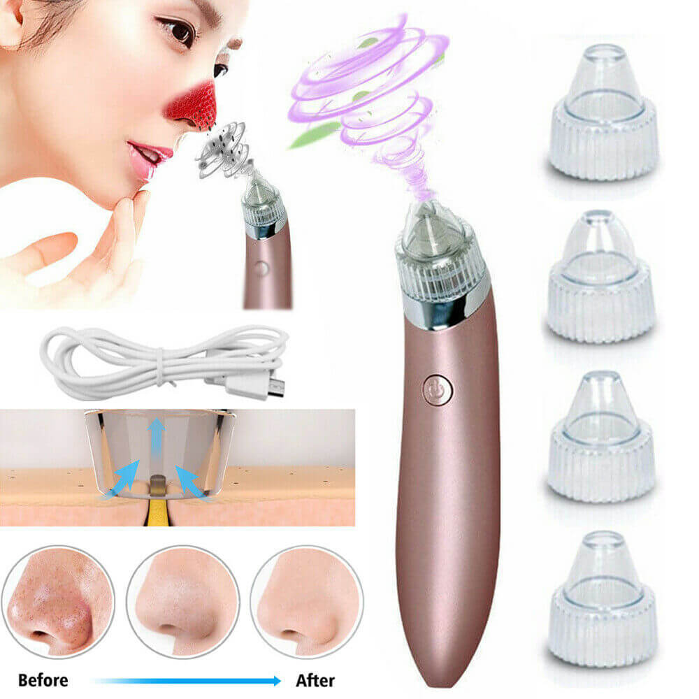 Electric Blackhead Vacuum: Pore Cleaner, Acne Remover & Diamond Dermabrasion Tool