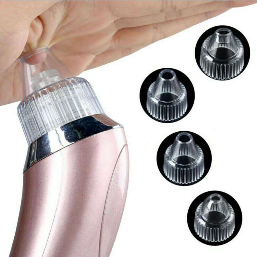 Electric Blackhead Vacuum: Pore Cleaner, Acne Remover & Diamond Dermabrasion Tool
